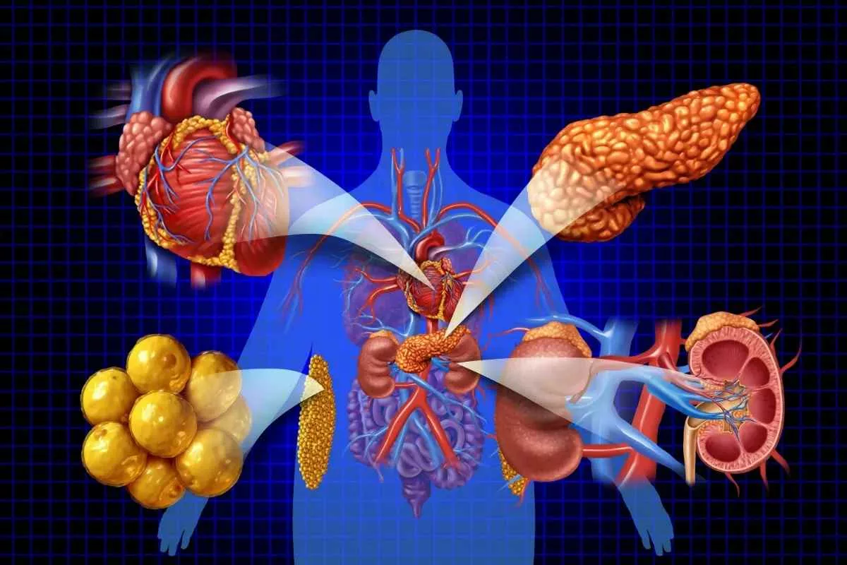 health-condition-many-have-never-heard_11zon