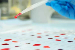 راز خون طلایی فاش شد؛ فقط ۵۰ نفر در جهان صاحب نادرترین گروه خونی Rh‑null هستند!