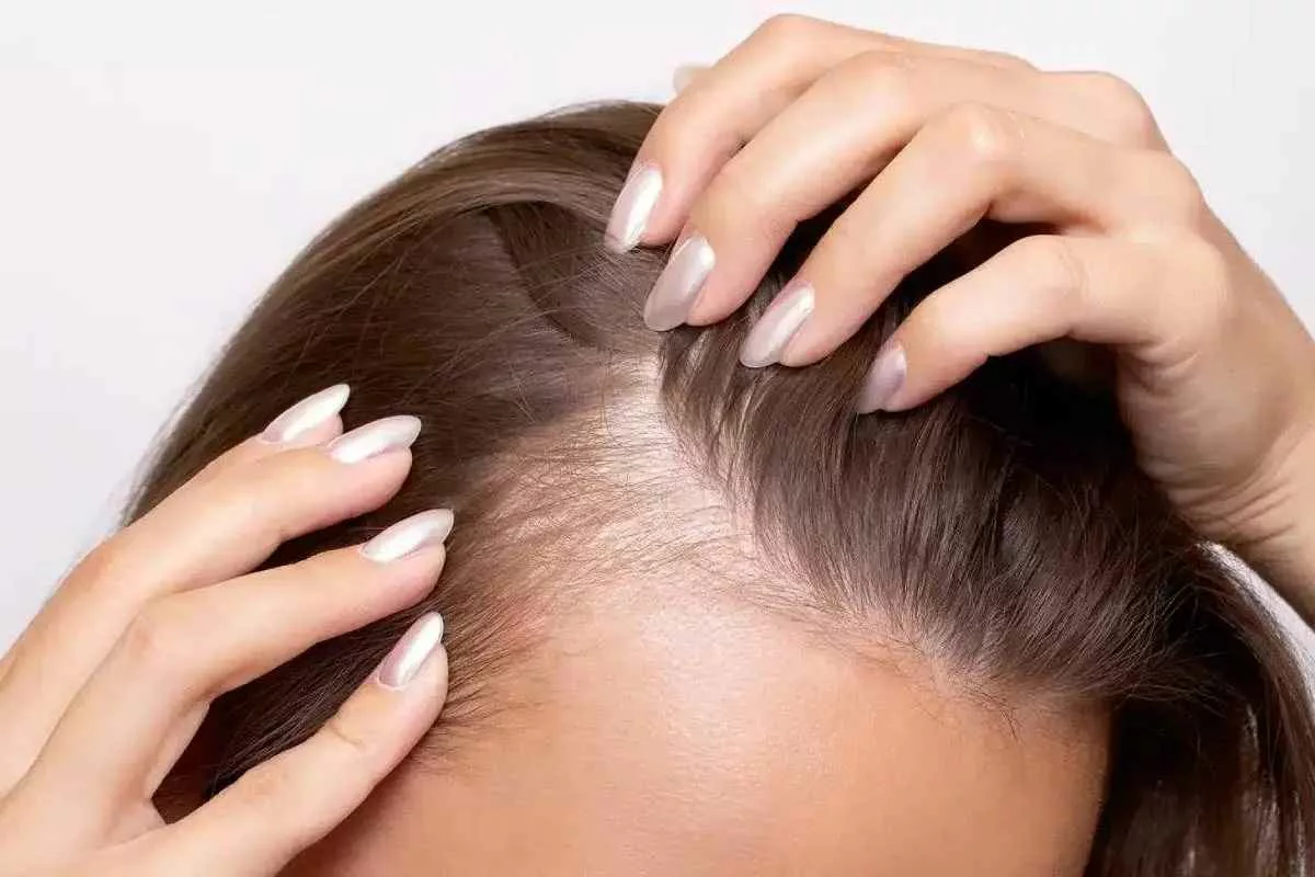 stress-induced-hair-loss-mechanism_11zon