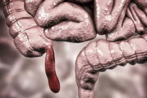 افزایش مرموز یک سرطان نادر در نسل جوان؛ هشدار جدی دانشمندان درباره روندی غیرقابل‌پیش‌بینی