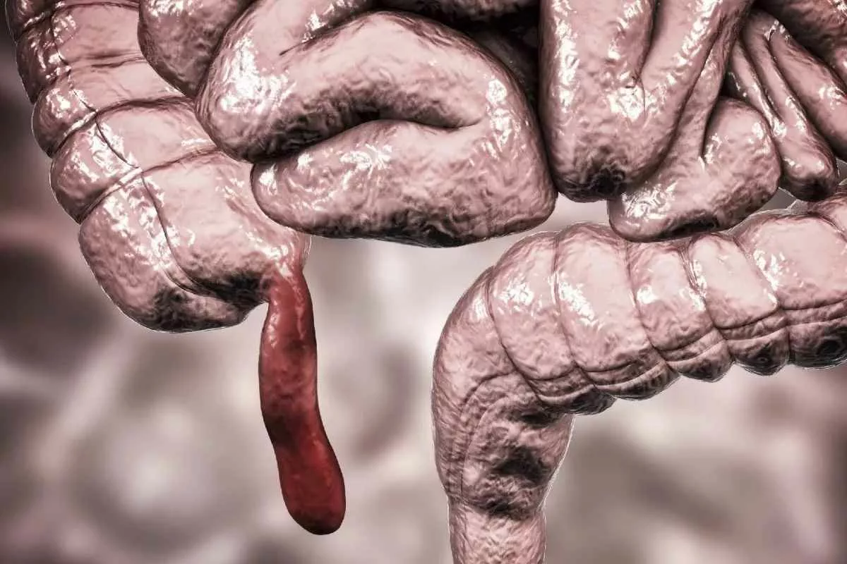 rare-cancer-surging-young-people_11zon