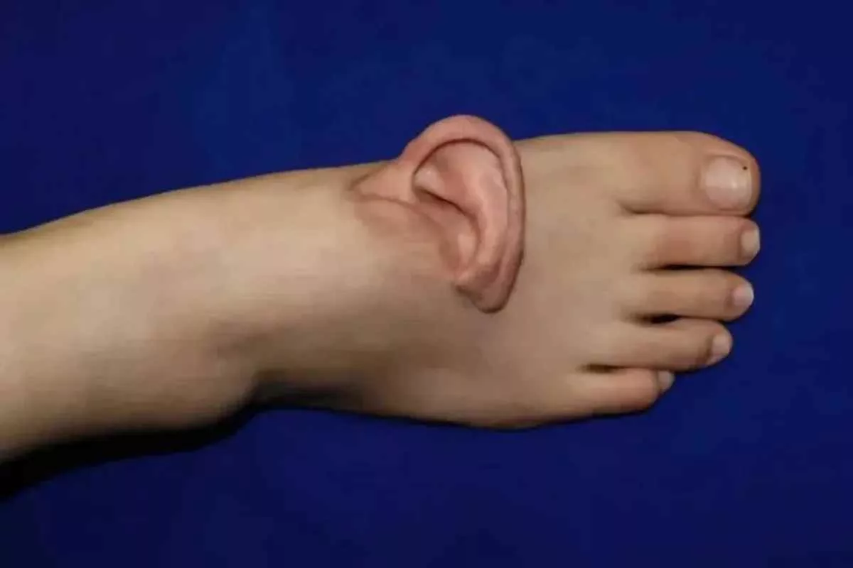scientists-graft-human-ear-foot_11zon